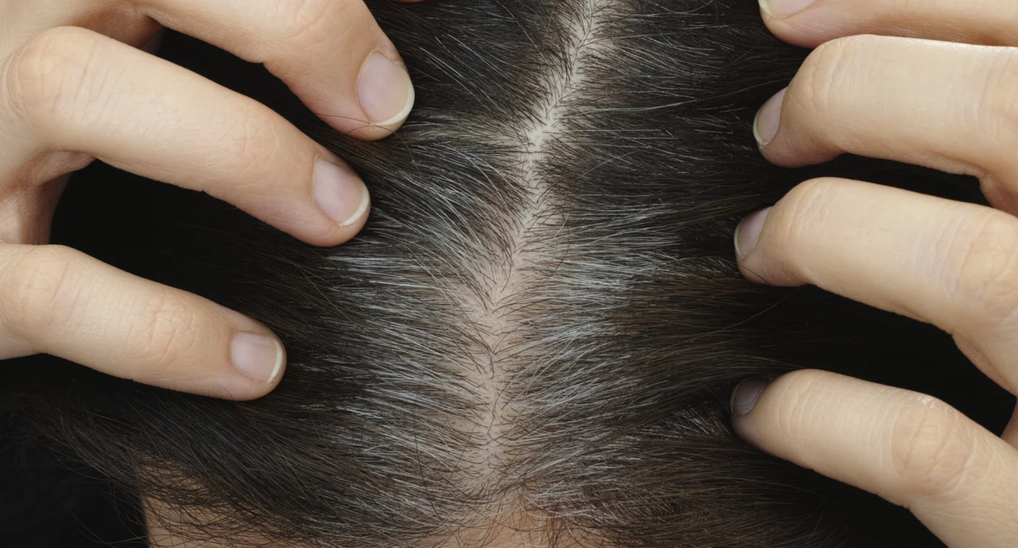 a person showing their gray hairs emerging