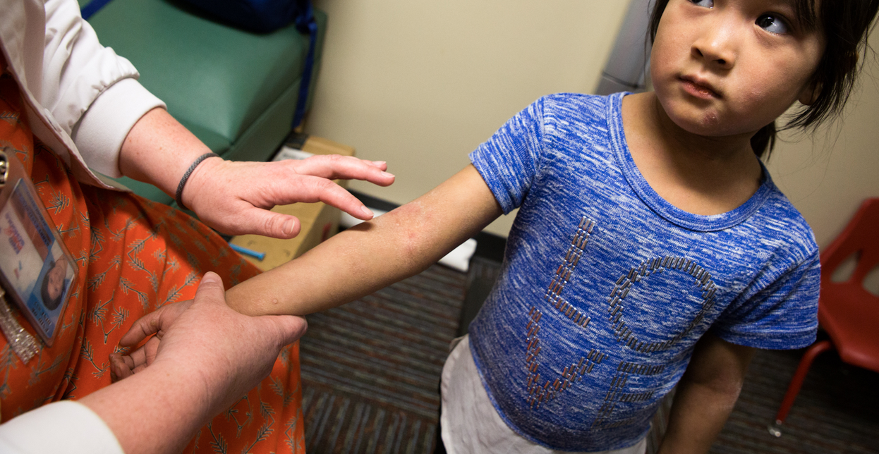 a girl with a rash getting examined